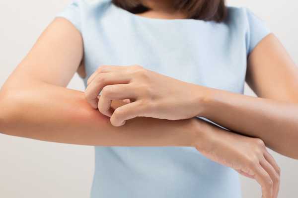 Secret Remedies for Fast Itchy Skin Rash Relief