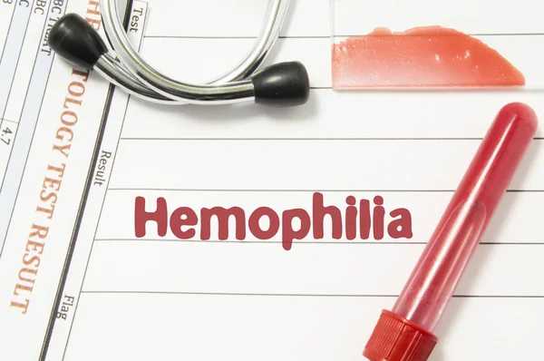 Homeopathy in Hemophilia: A Natural Approach to Supporting Healing