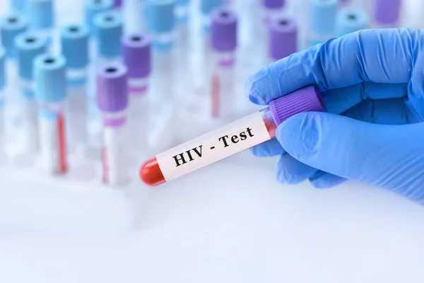 Injectable HIV Prevention: A Revolutionary Approach to Combating the Epidemic