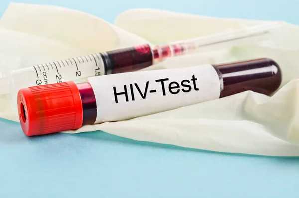 A New Era in HIV Prevention: Exploring Injectable Solutions